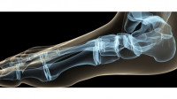 X-Ray