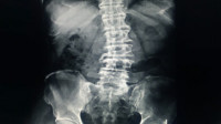 X-Rays