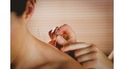 Acupuncture Chicago