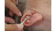 Auricular Acupuncture